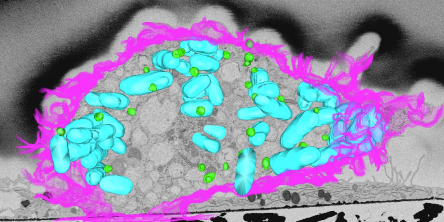 3D Electron Microscopy 