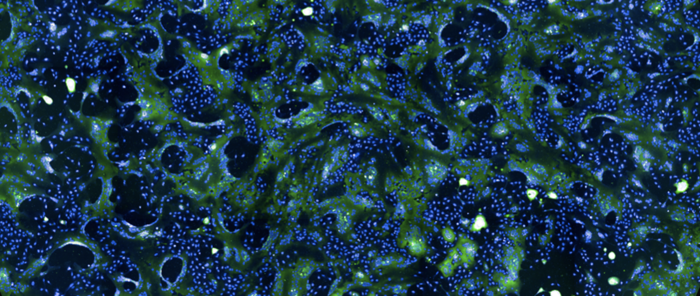 Cells infected with the SARS-CoV-2 Omicron variant.