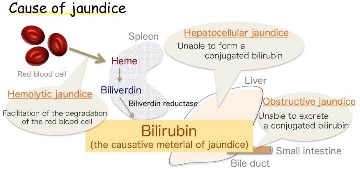 Figure 1: Cause of Jaundice