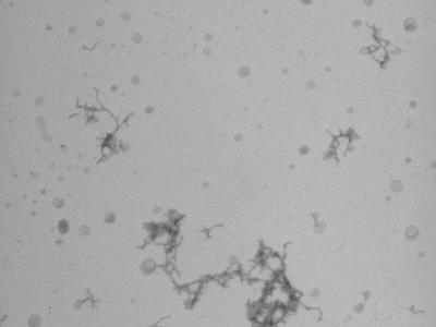Beta-Amyloid Aggregation Process