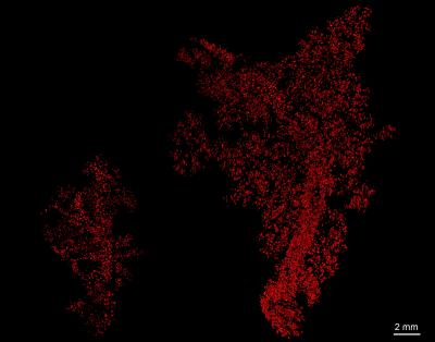 Insulin-producing Islets of Langerhans (Red) in a Mouse Pancreas