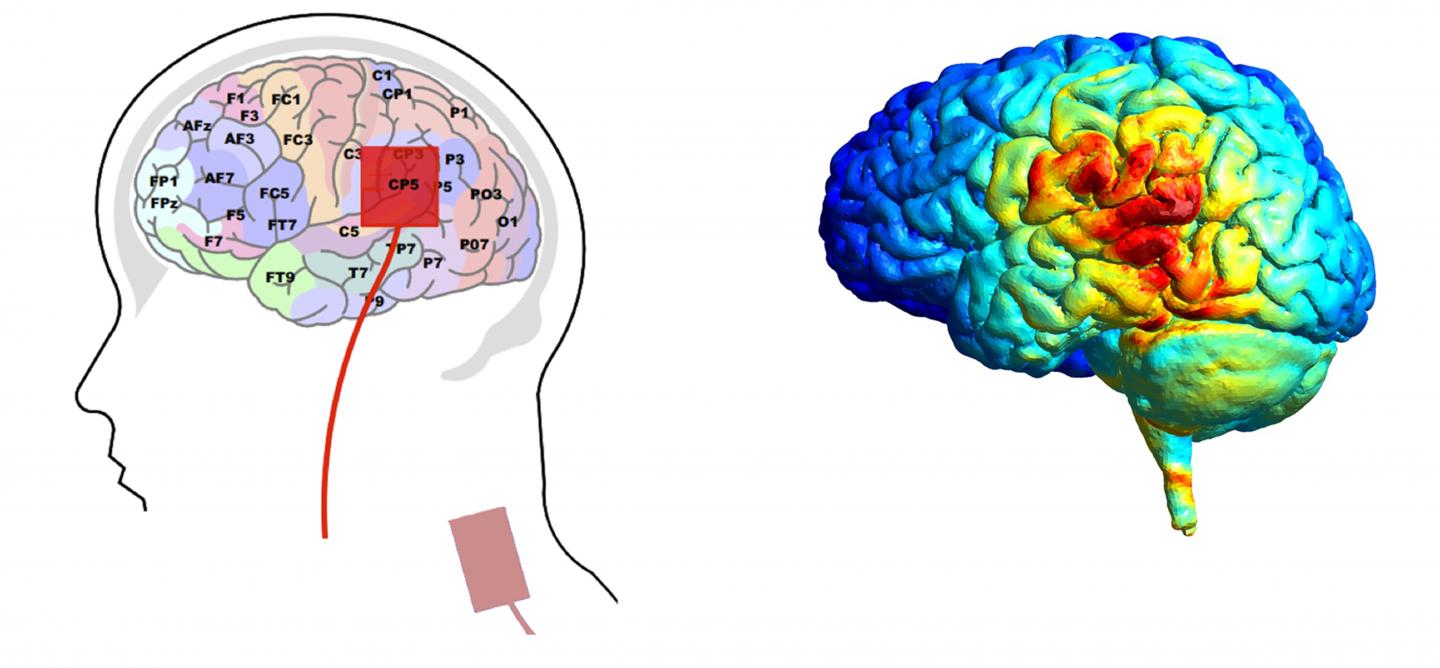 Placement of Electrodes