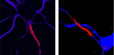 Evolution and Epilepsy