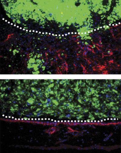 Fibroblasts with Snail1 Invade Extracellular Matrix