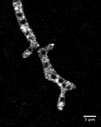 Protein-RNA Droplets in the Fungus <em>Ashbya gossypii</em>