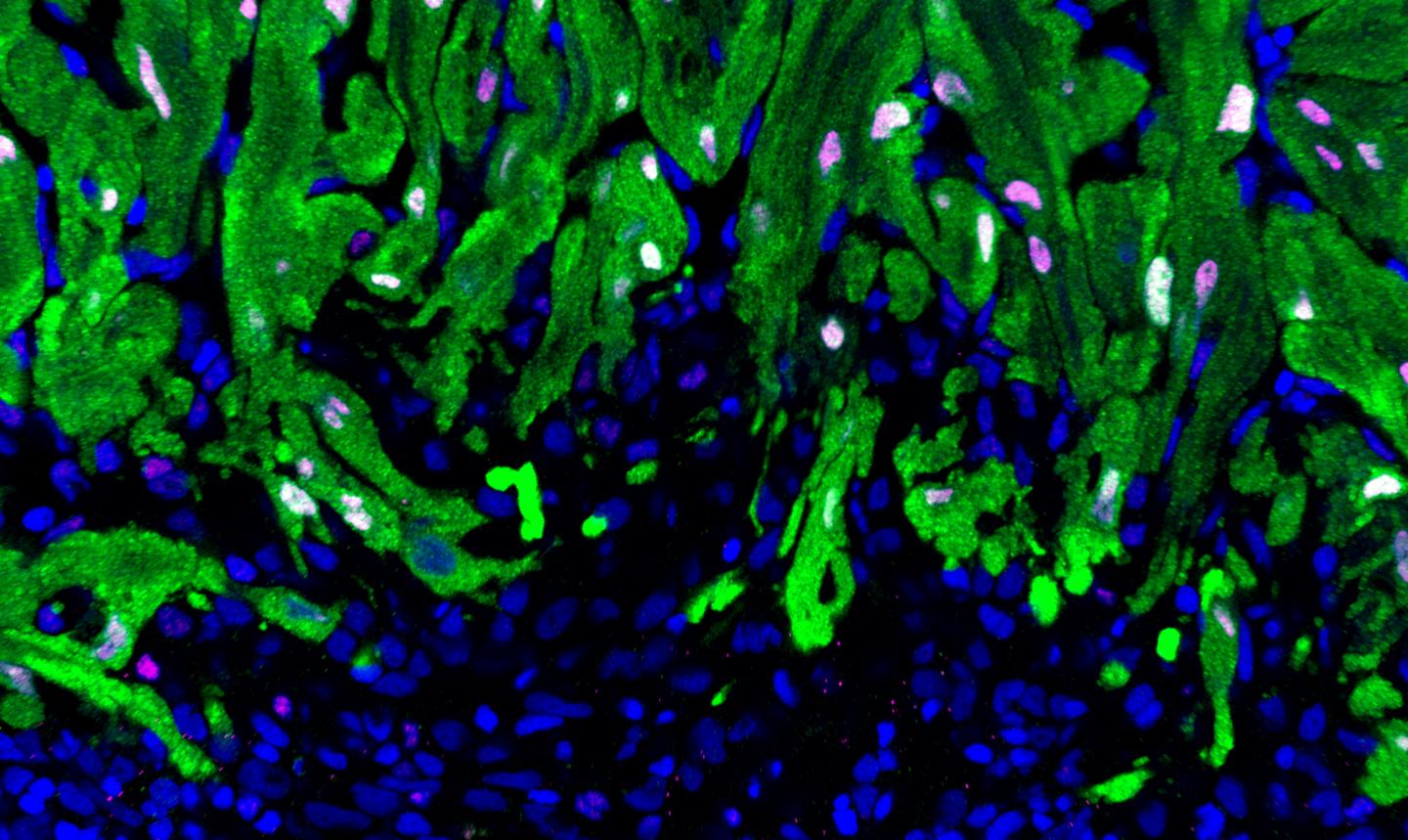 Heart Muscle Cells