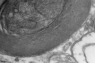 Optogenetics Links Neuronal Activity to Adaptive Changes in Myelin (2 of 6)