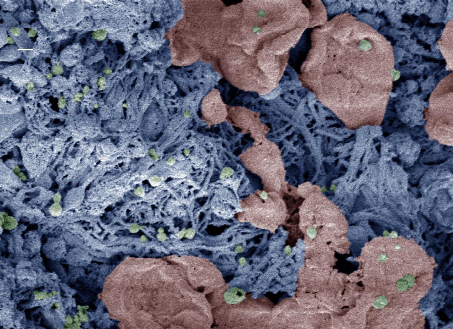 Nanoparticles that Speed Blood Clotting May Someday Save Lives