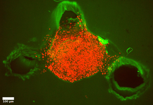 Tumour model