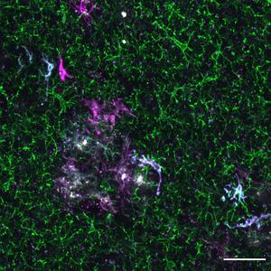 Image of human microglia engrafted in a mouse brain