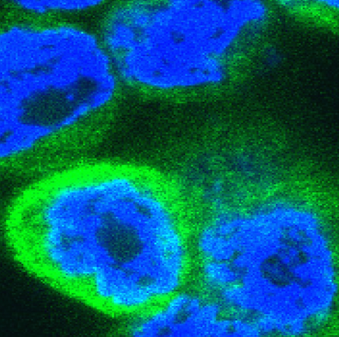 Inflammatory cytokines