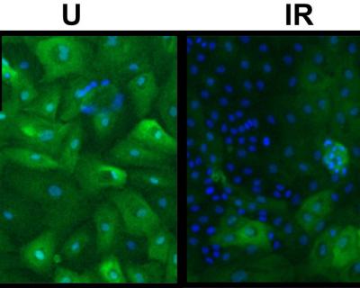 Breast Cells with Stained p-16