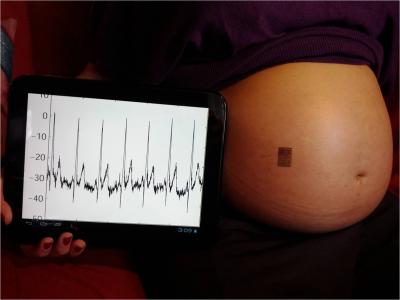 Epidermal Electronics for Wireless Pregnancy Monitoring