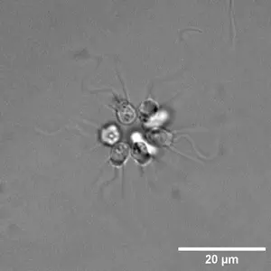 A rosette-shaped colony of S. rosetta