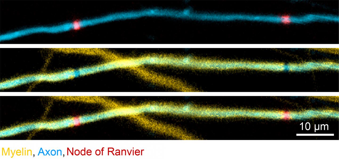 An Axon with Myelin and Nodes of Ranvier Highlighted