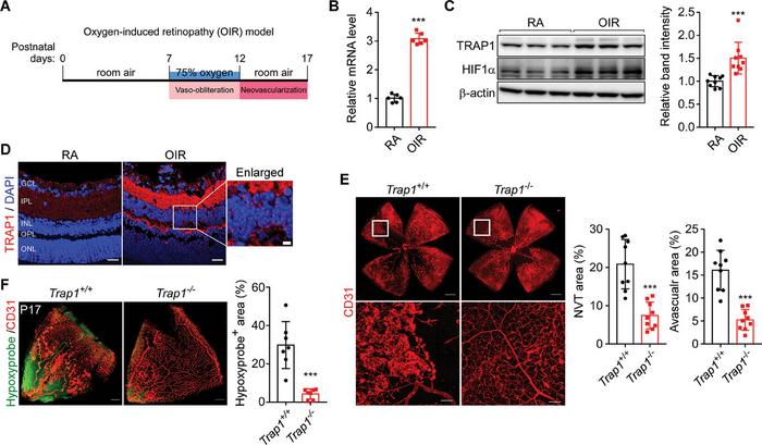 Contribution of TRAP1 to the development of ischemic retinopathy.