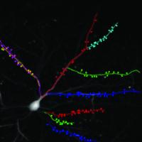 A Single Nerve Cell in the Cortex of a Live Mouse