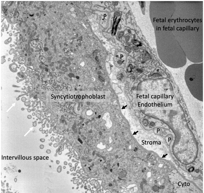 Electron microscopy image of a cross section of the human placental barrier at term