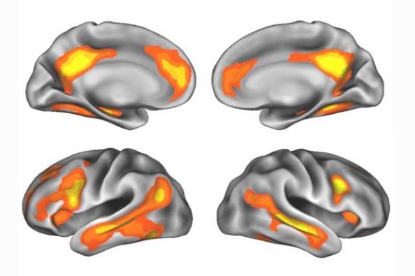 Brain Regions with Volume Changes after Pregnancy