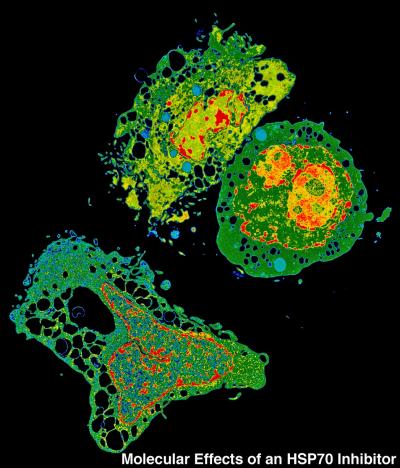 Inhibitor of Heat Shock Protein is a Potential Anticancer Drug