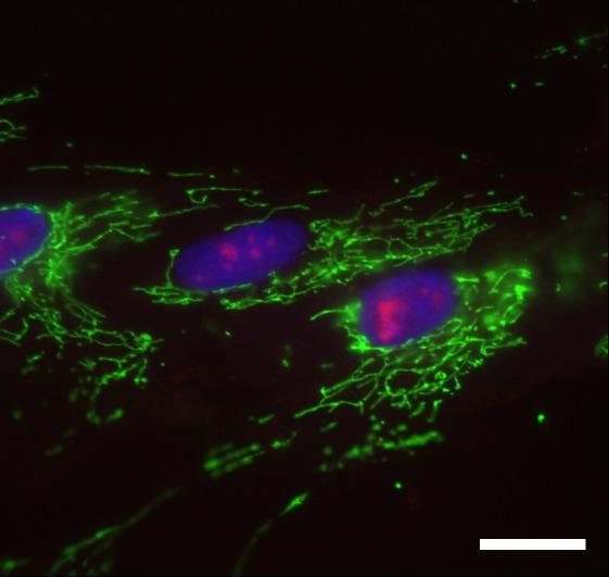 Young Fibroblast Cells