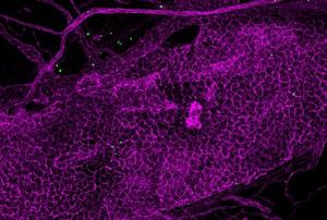 Immune cells producing IL-17