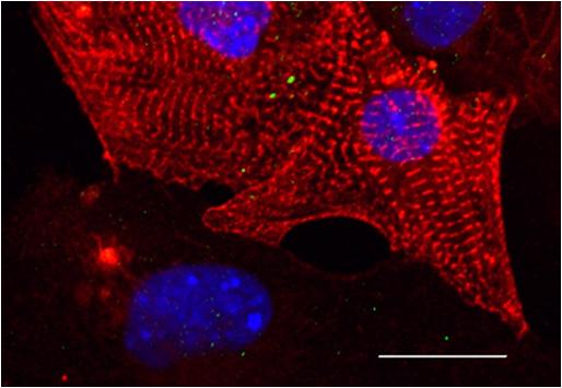 Micrograph of Heart Muscle Cells (Cardiomyocytes)
