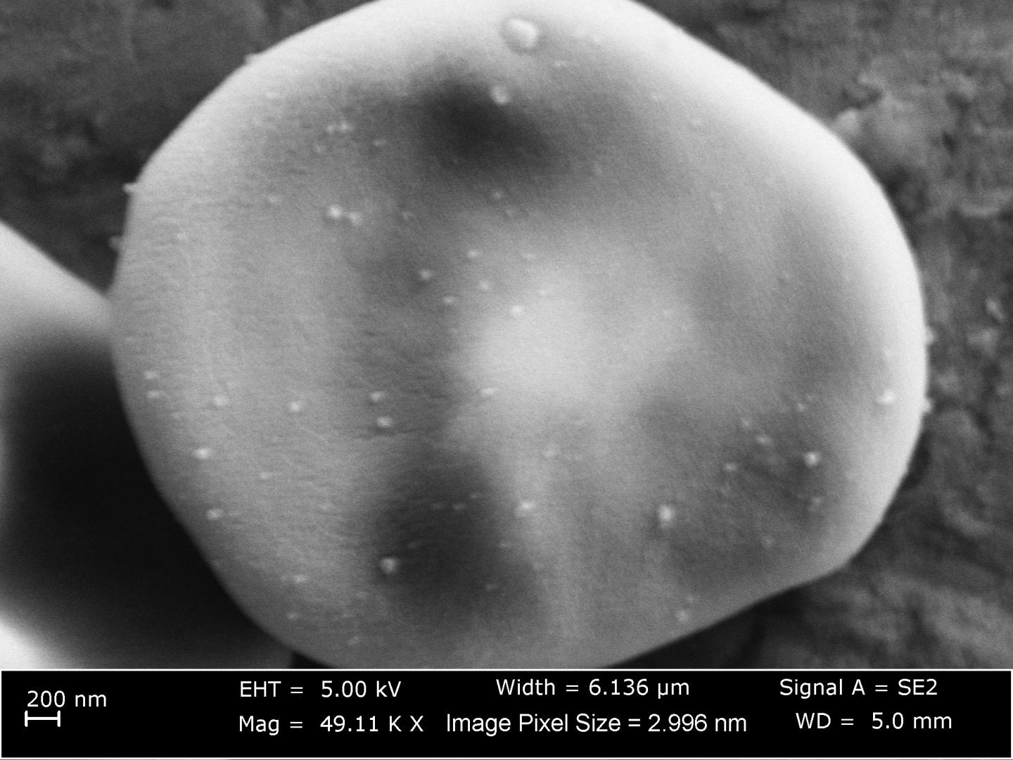 Nanoparticles on red blood cells