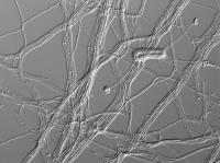 <em>Acremonium egyptiacum</em> under a Microscope