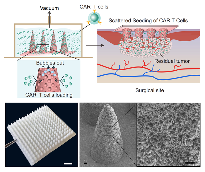 Schematic of porous microneedle deliver CAR T cells into the solid tumor