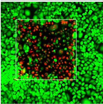 Enhanced PDT Therapy