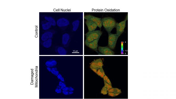 Mitochondria Meltdown Pummels Cell Nuclei