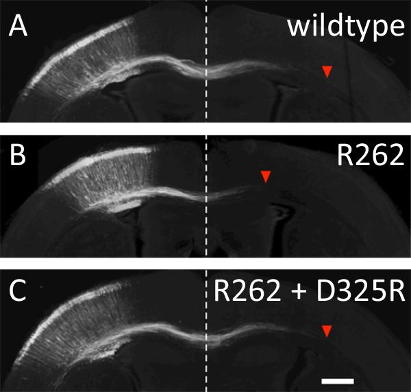 Rescue of Axonal Growth with Kinesin Mutants