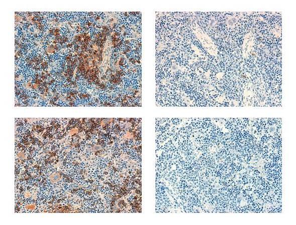 Mouse Spleens Infiltrated by TAL1-Positive T-ALL Leukemia Cells