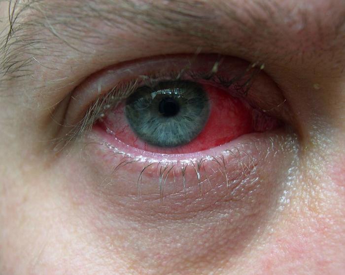 Stem Cell Shots: Unveiling a Safer Way to Treat Inflammatory Eye Diseases