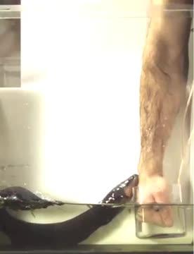 Electric Eel's Power Transfer to a Human