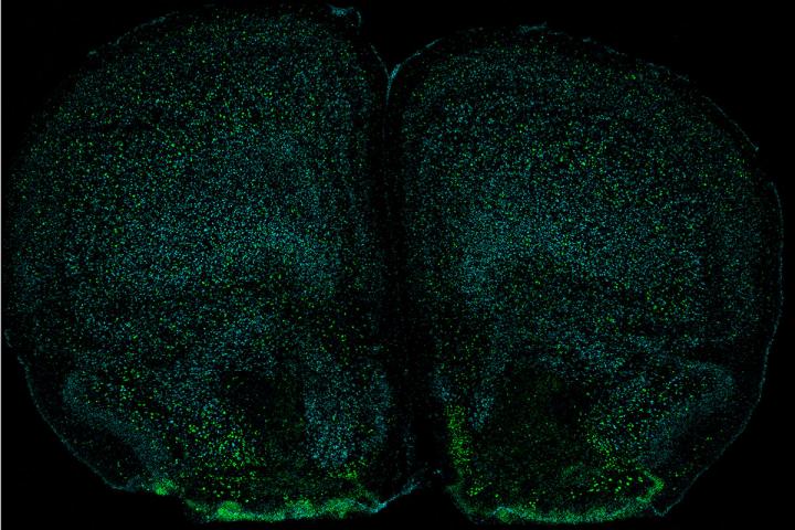 Neurons with IL-17 receptor