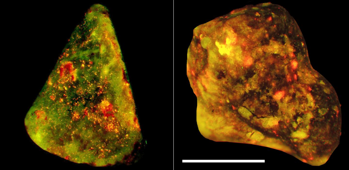 Neutrophil Elastase on Human Gallstones