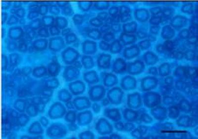Semithin Sciatic Nerve