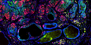 Novel immunotherapy mechanism suppresses breast cancer development