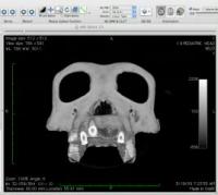 CT Scan of a Chimpanzee Skull