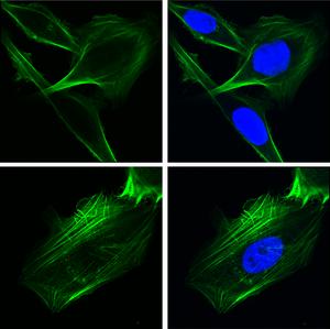 GRP78 Cancer Cell behavior