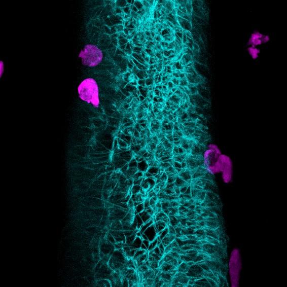 How The Microbiota Controls Neutrophil Activity