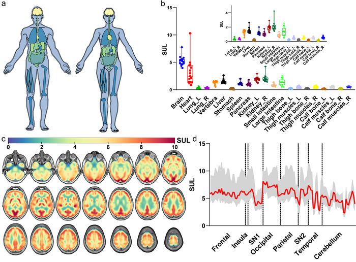 An atlas of glucose uptake across the entire human body as measured by the total-body PET/CT scanner: a pilot study