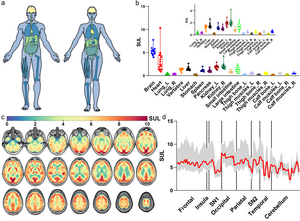 An atlas of glucose uptake across the entire human body as measured by the total-body PET/CT scanner: a pilot study