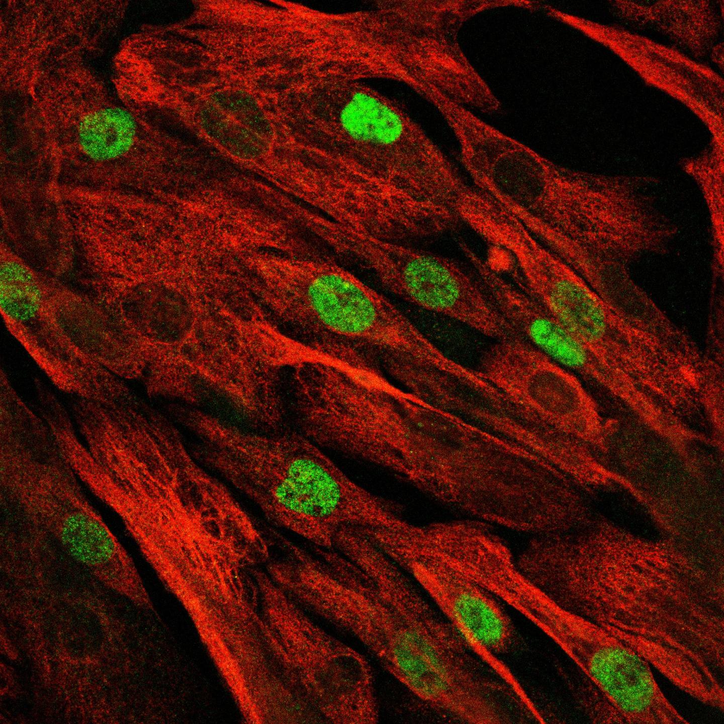 Muscle stem cells