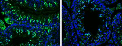 p73 and Male Infertility