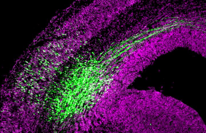 Akna Regulates Migration of Cells