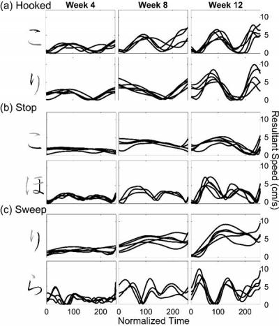 Time-Normalized Resultant Speed Profiles of Pen-Tip