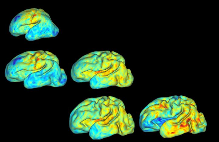 3-D Mapping Babies' Brains